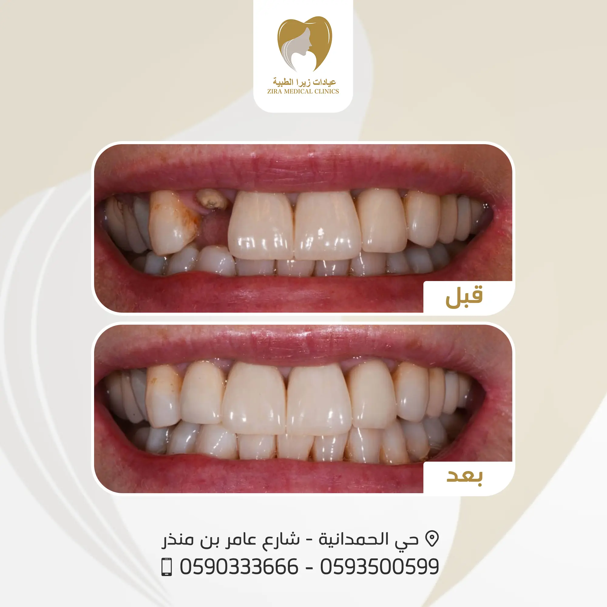 1-ezgif.com-png-to-webp-converter