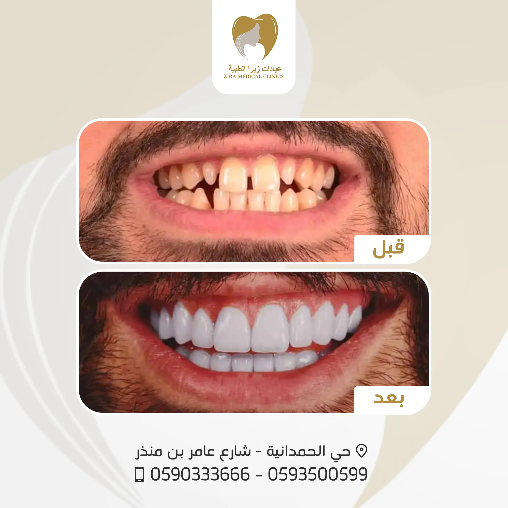 2-ezgif.com-png-to-webp-converter