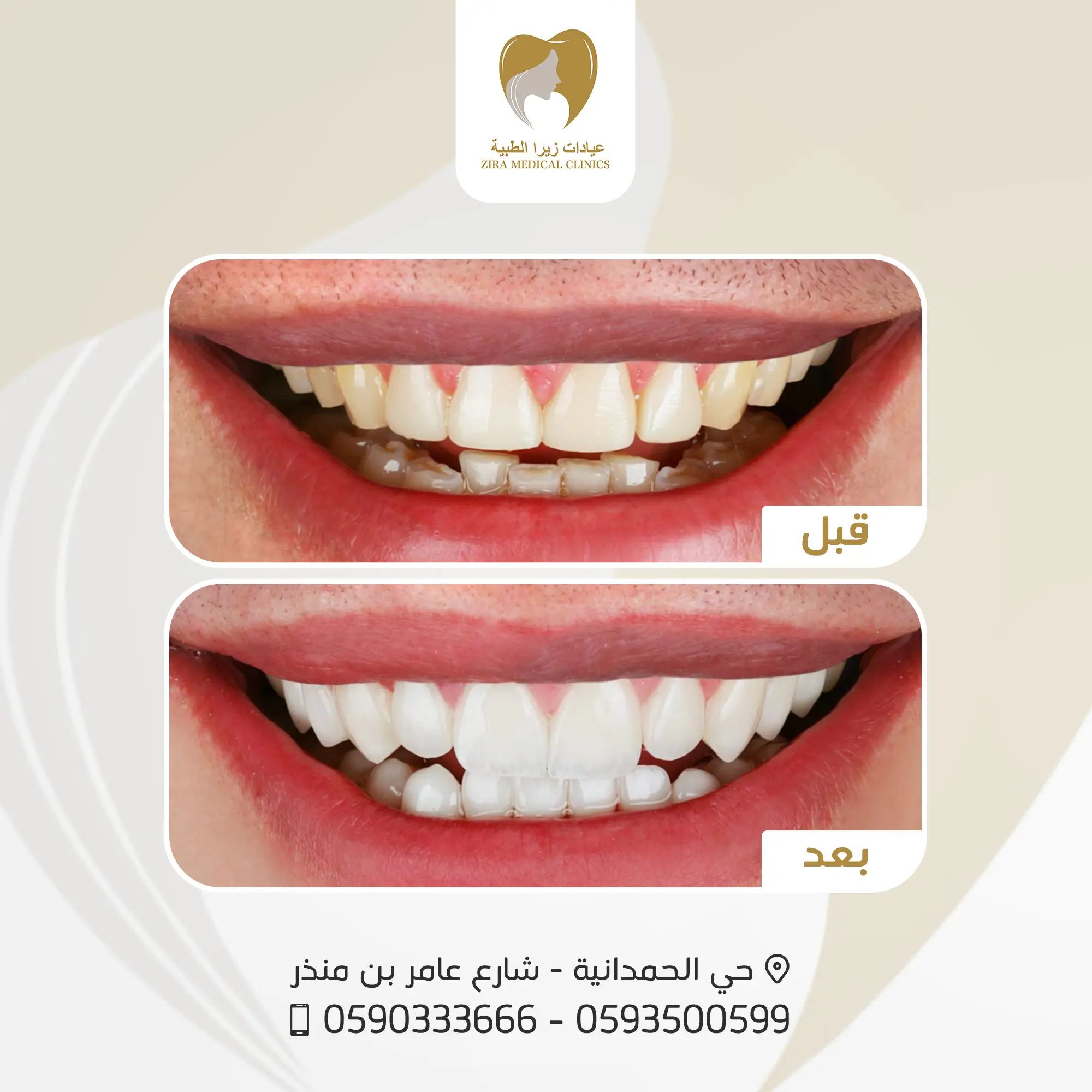 3-ezgif.com-png-to-webp-converter