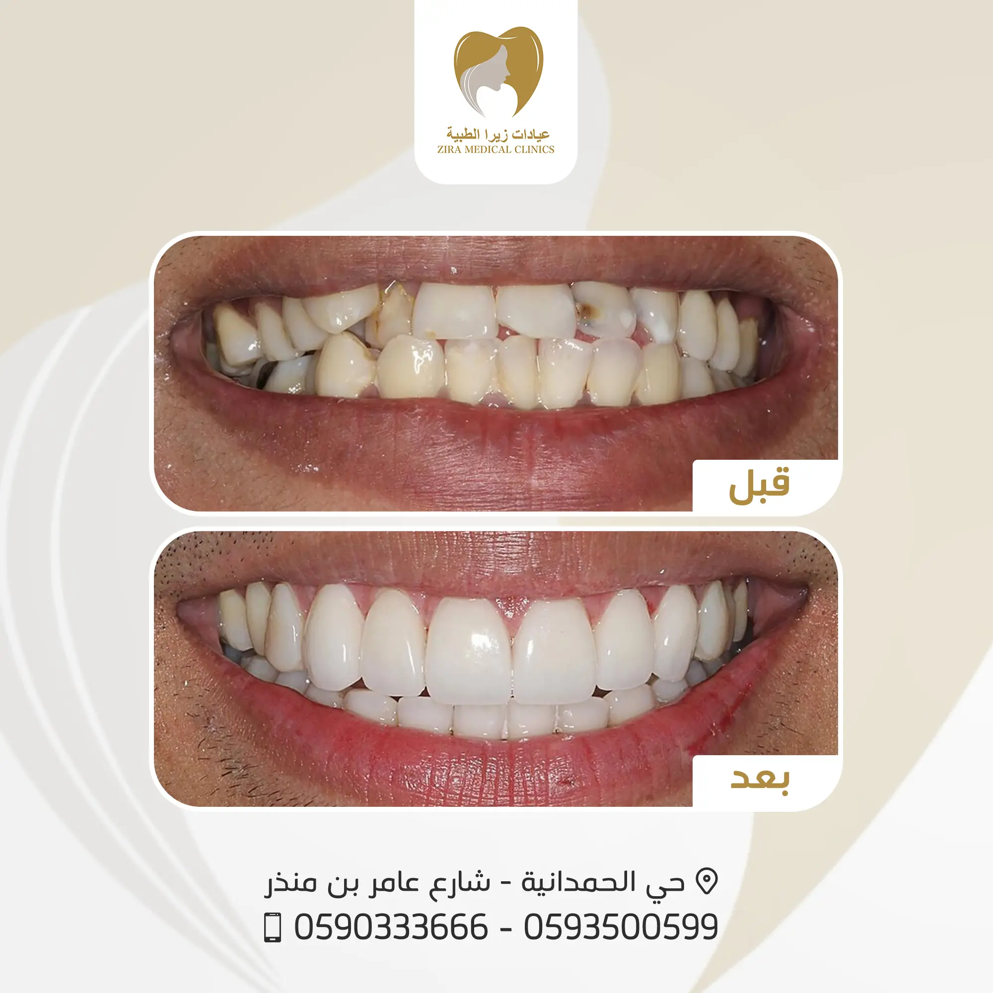 4-ezgif.com-png-to-webp-converter